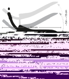 Speculum w Air&Liquid Tube Gol