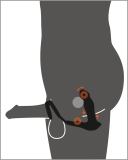 RC Vibrating Prostate Plug Nod