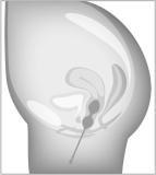 beau coeur Elorin Love BallSet